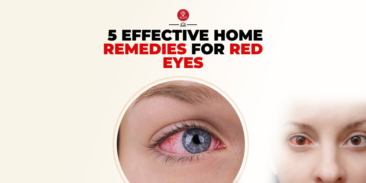 Home Remedies For Red Eyes