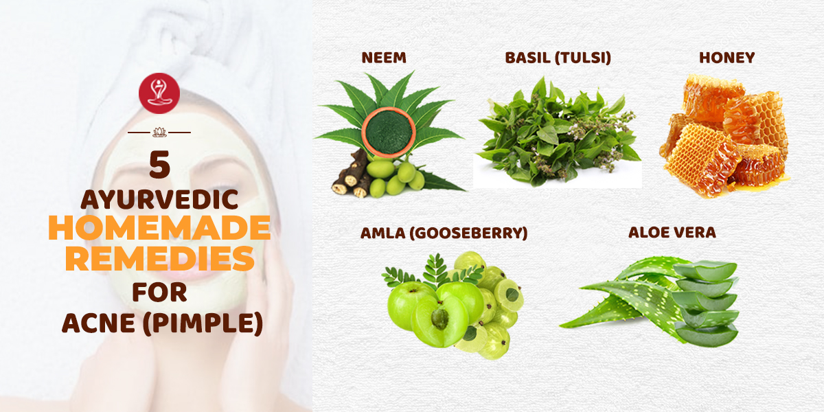 Remedies for Acne